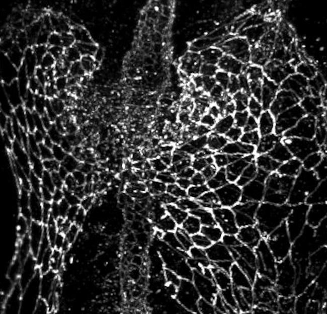 Different shapes of cardiomyocytes during heart tube formation