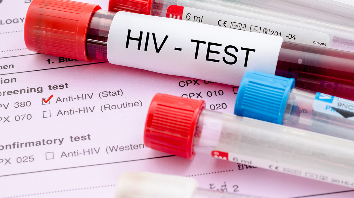 Several capped vials -- one filled with red liquid and labeled 'HIV-TEST' sit on a printed form.